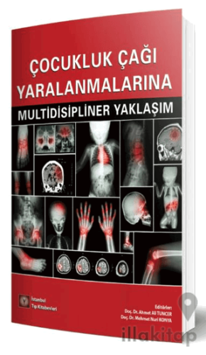 Çocukluk Çağı Yaralanmalarına Multidisipliner Yaklaşım