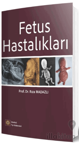 Fetus Hastalıkları