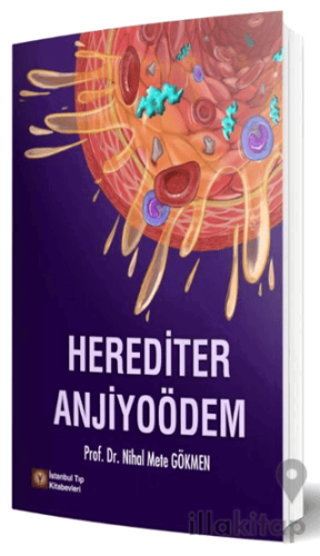 Herediter Anjiyoödem