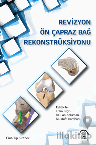 Revizyon Ön Çapraz Bağ Rekonstrüksiyonu