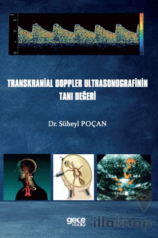 Transkranial Doppler Ultrasonografinin Tanı Değeri