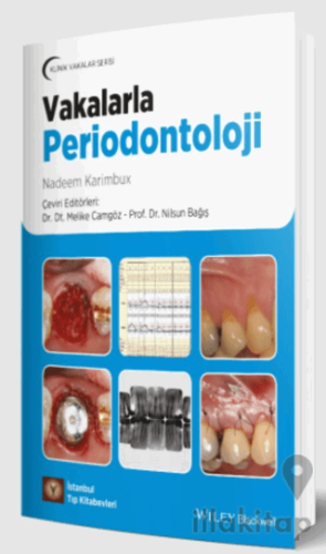 Vakalarla Periodontoloji